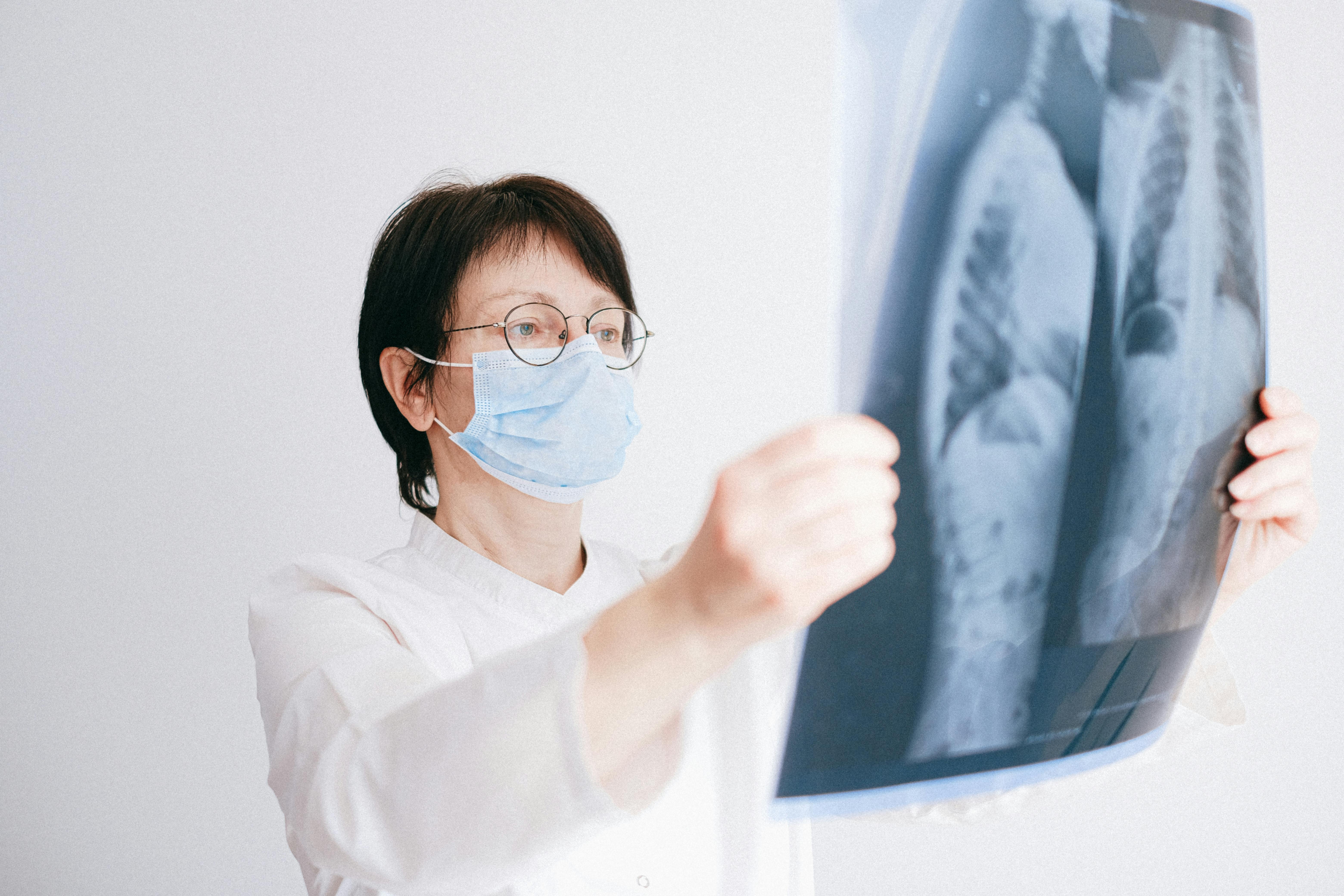Free Doctor Looking at Lung Scans She Is Holding Stock Photo