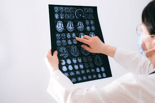 mri, 가리키는, 뇌의 무료 스톡 사진