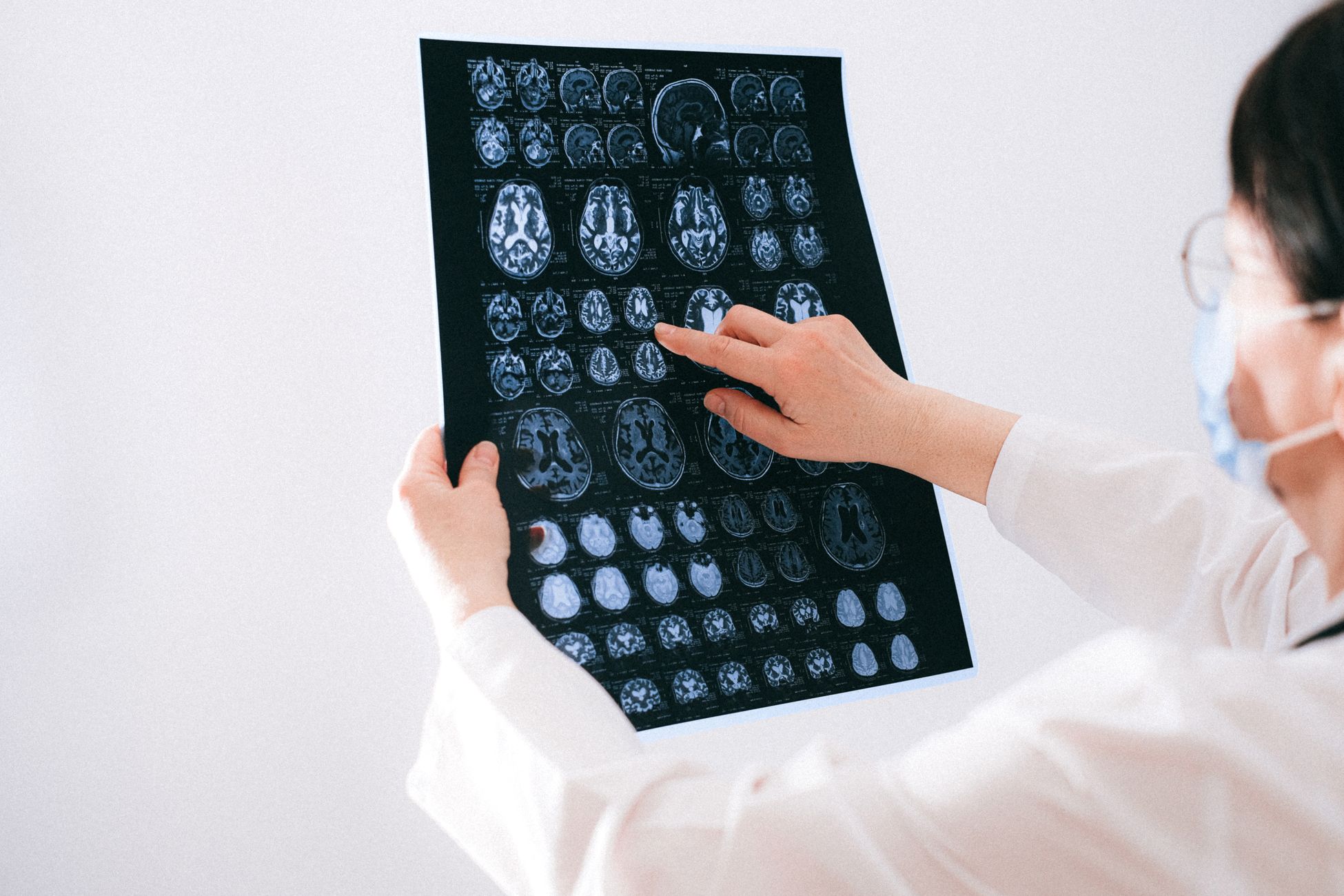 Patiënten met herseninfarct krijgen sneller hulp in Nederlandse ziekenhuizen
