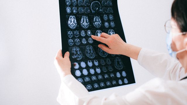 Study: Students With Dyslexia Show Differences in a Key Brain Reading Region