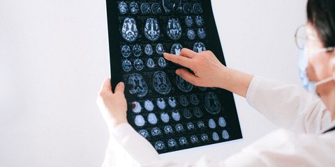 Doctor examines brain MRI scans closely for medical diagnosis in a hospital environment.