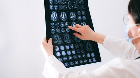 Doctor examines brain MRI scans closely for medical diagnosis in a hospital environment.