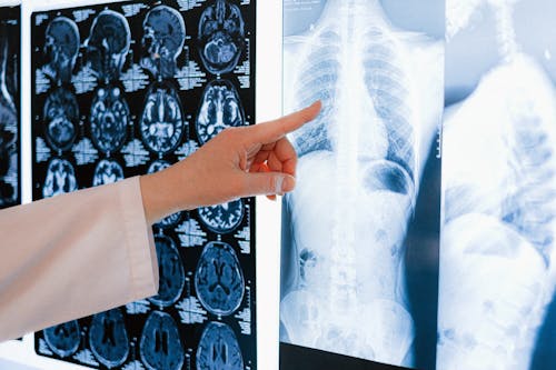 Δωρεάν στοκ φωτογραφιών με x ray, αιχμή, ανατομία