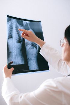 A doctor analyzing a spinal X-ray for medical diagnosis in a healthcare setting.