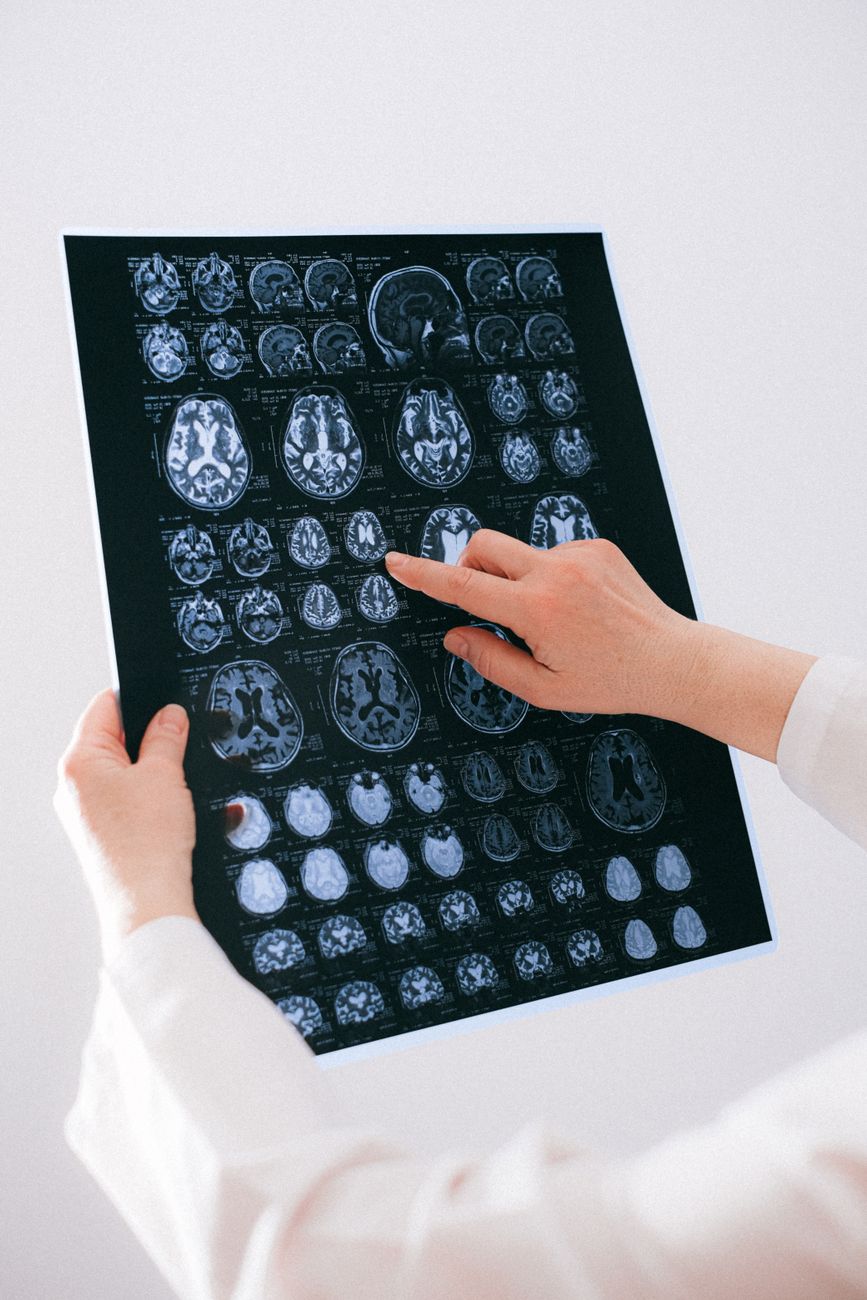 Hands holding a brain scan image, representing the intersection of clinical care and neurological research