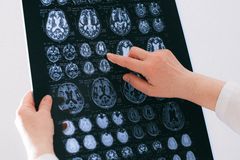 A medical professional examines a brain MRI scan, focusing on neurological health.