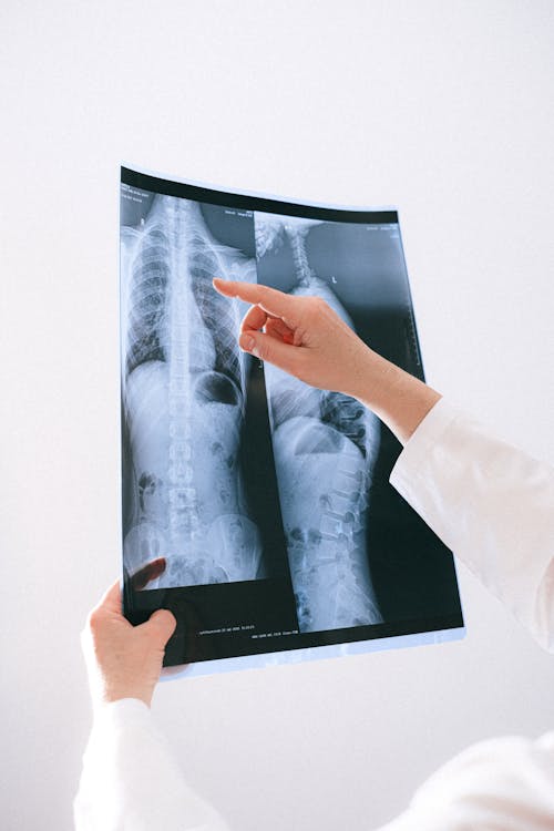 Free A Person Holding a X-ray Result Stock Photo