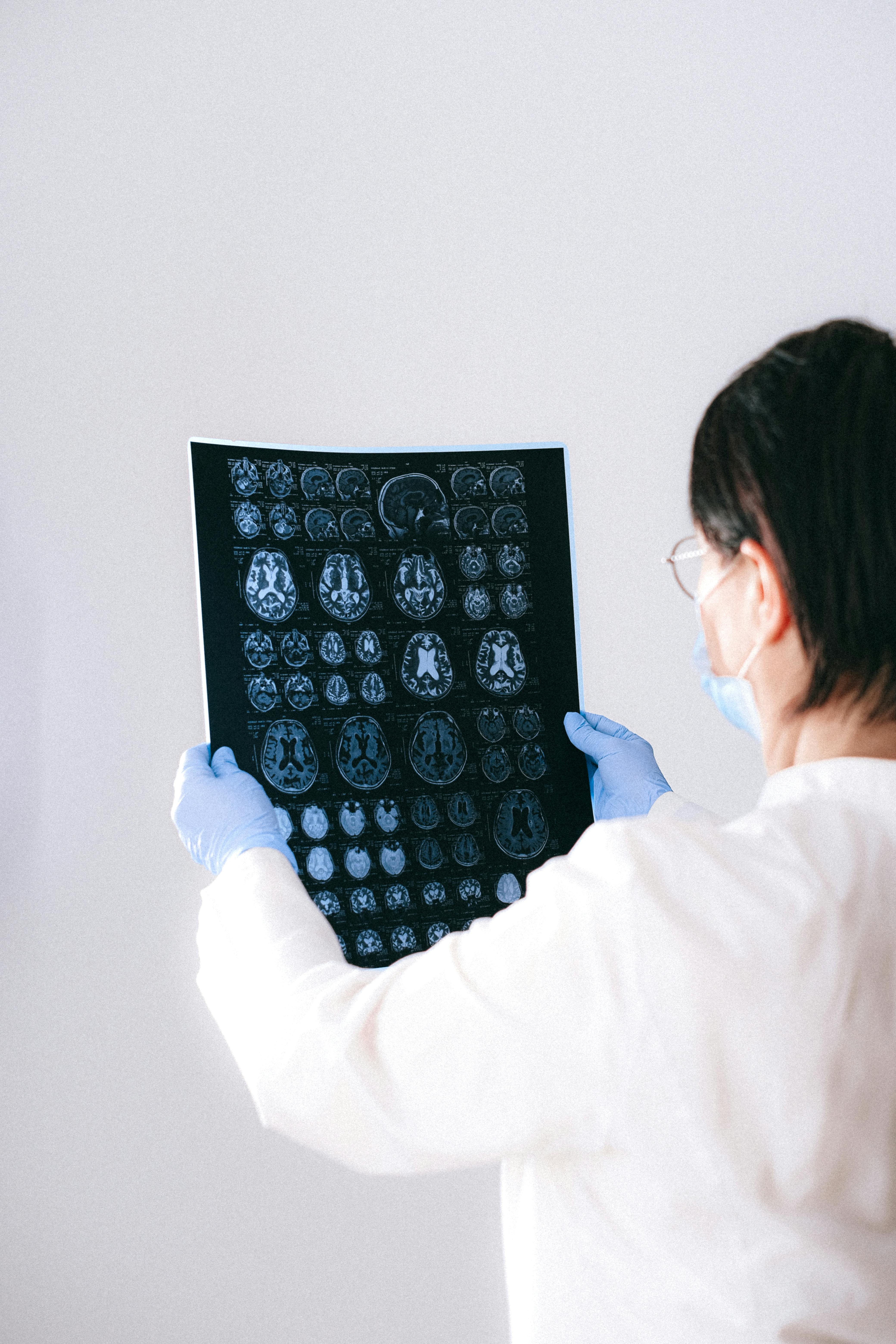 Person in lab coat examining brain scans, wearing gloves and mask.