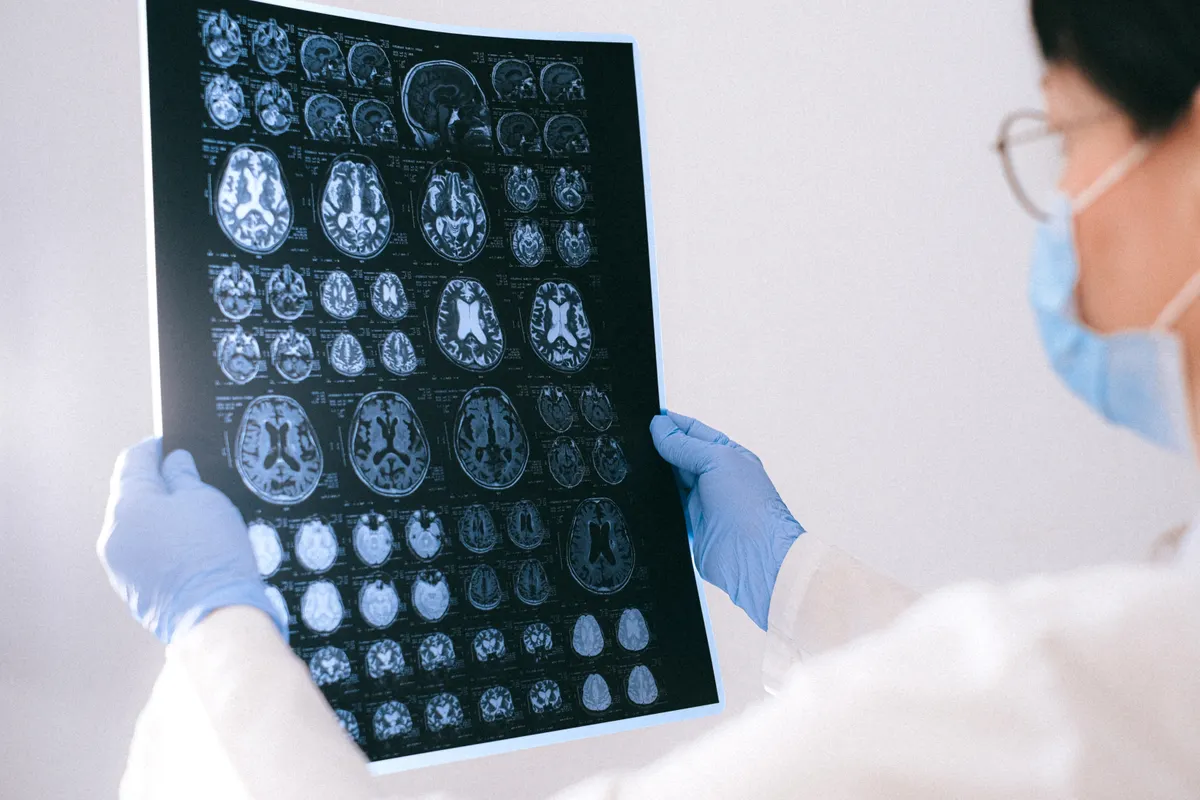 Why Does Alzheimers Disease Affect More Women? Female Risk Explained