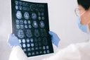 Why Does Alzheimers Disease Affect More Women? Female Risk Explained