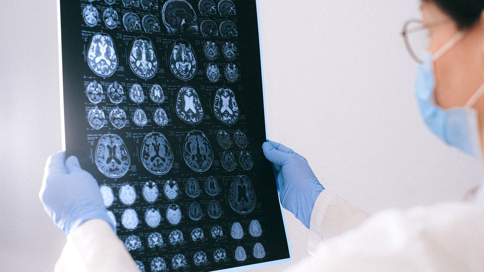 A medical professional reviewing MRI brain scans in a clinical setting, highlighting healthcare technology.