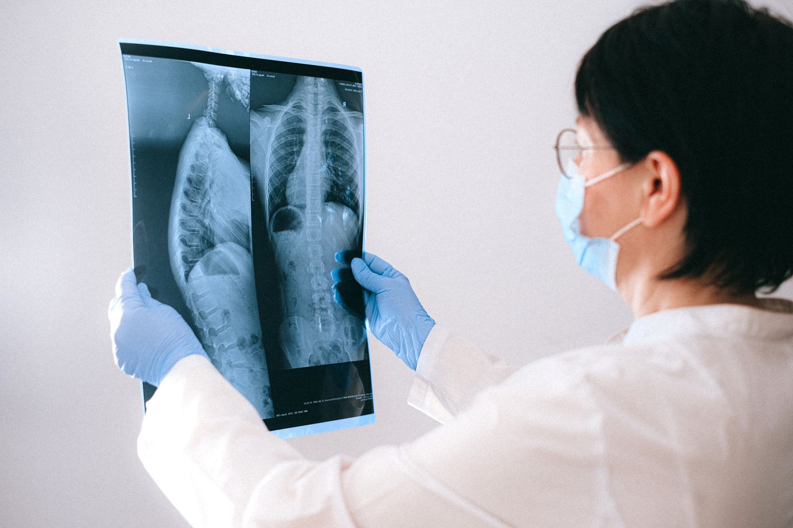 Radiologista analisando exame de mamografia em workstation