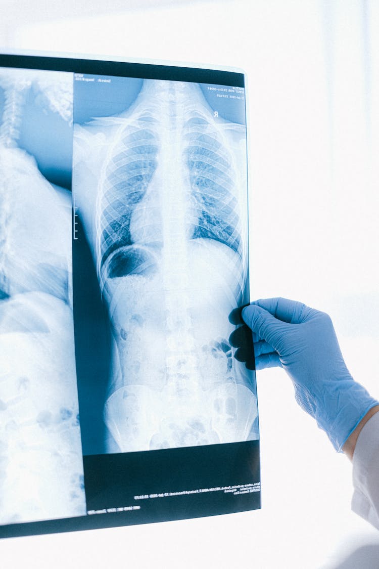 A Doctor Holding An X-ray Result