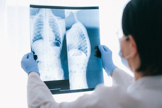 A Doctor Holding an X-ray Result