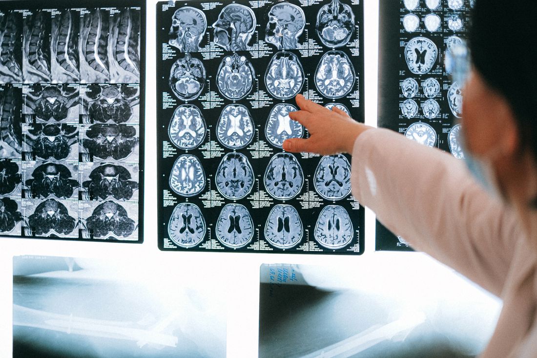 Radiologist reviewing scan images