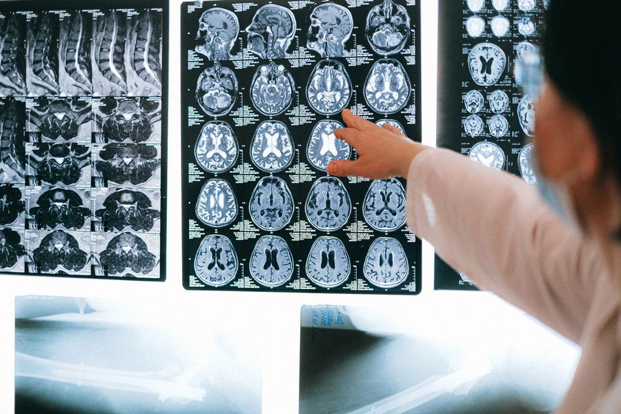Radiologist reviewing scan images on a lightbox
