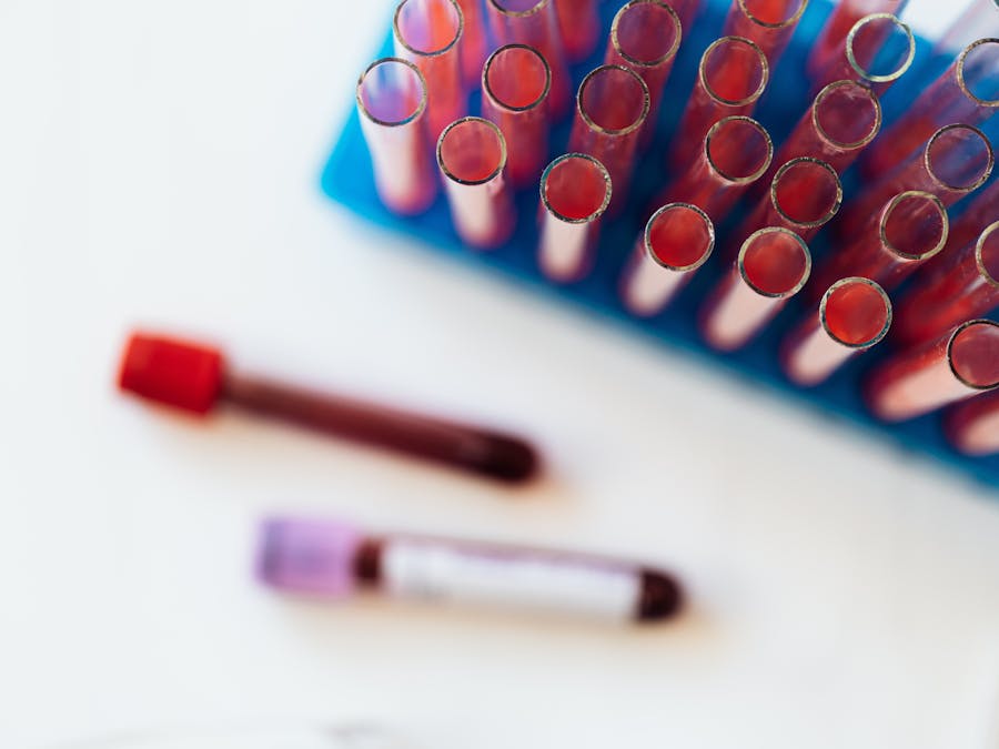 How can you tell fluid from fat?