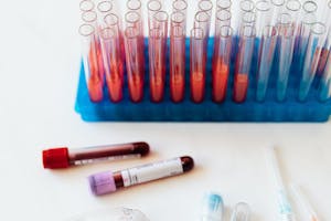 From above of plastic stand with test tubes of blood placed on white surface near vials of blood and syringe