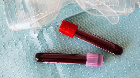Food sensitivity panels: what IgG testing measures and why interpretation is contested