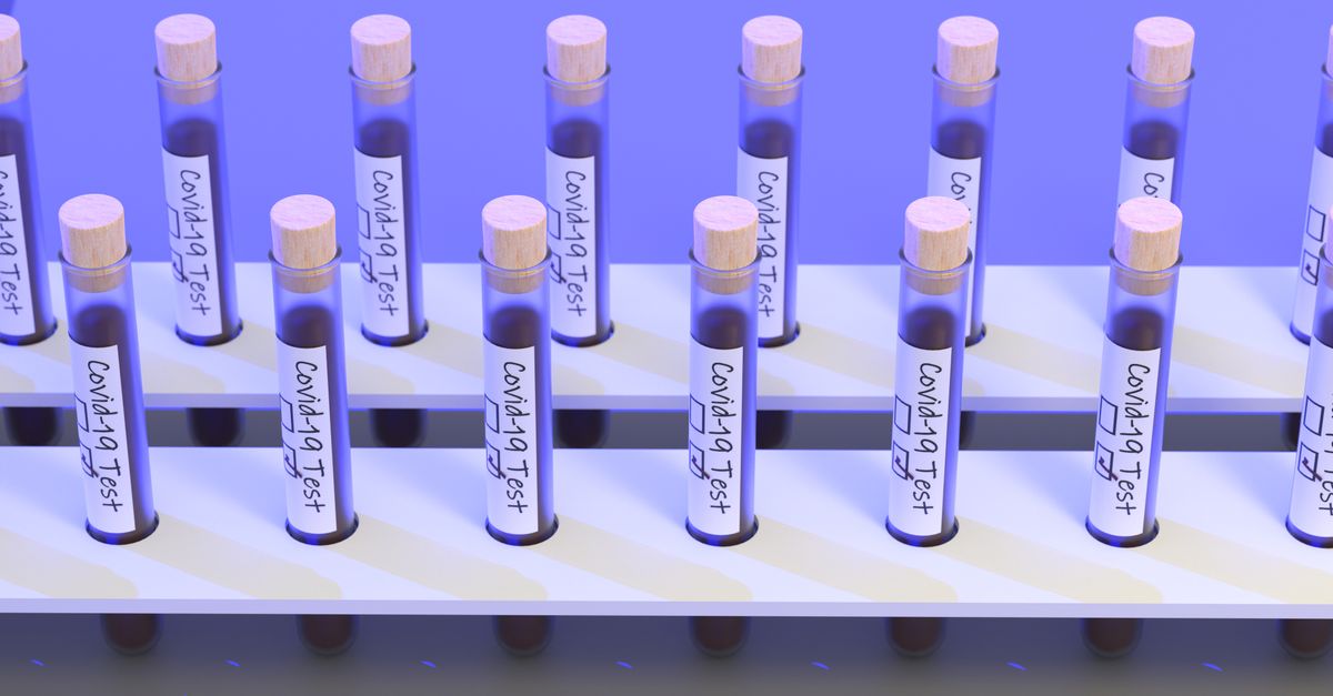 Molbio Diagnostics IPO: A Potential Opportunity for High-Risk Investors