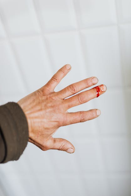 Crop Person With Bleeding Wound On Finger · Free Stock Photo