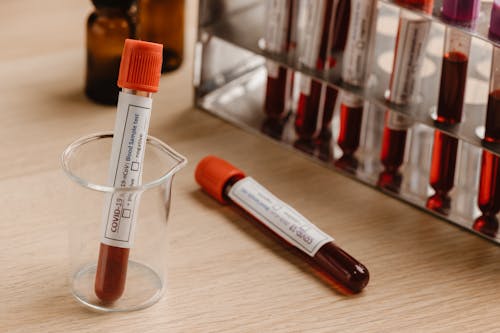 Free Close-Up Photo of a Blood Samples in a Blood Collection Tubes Stock Photo