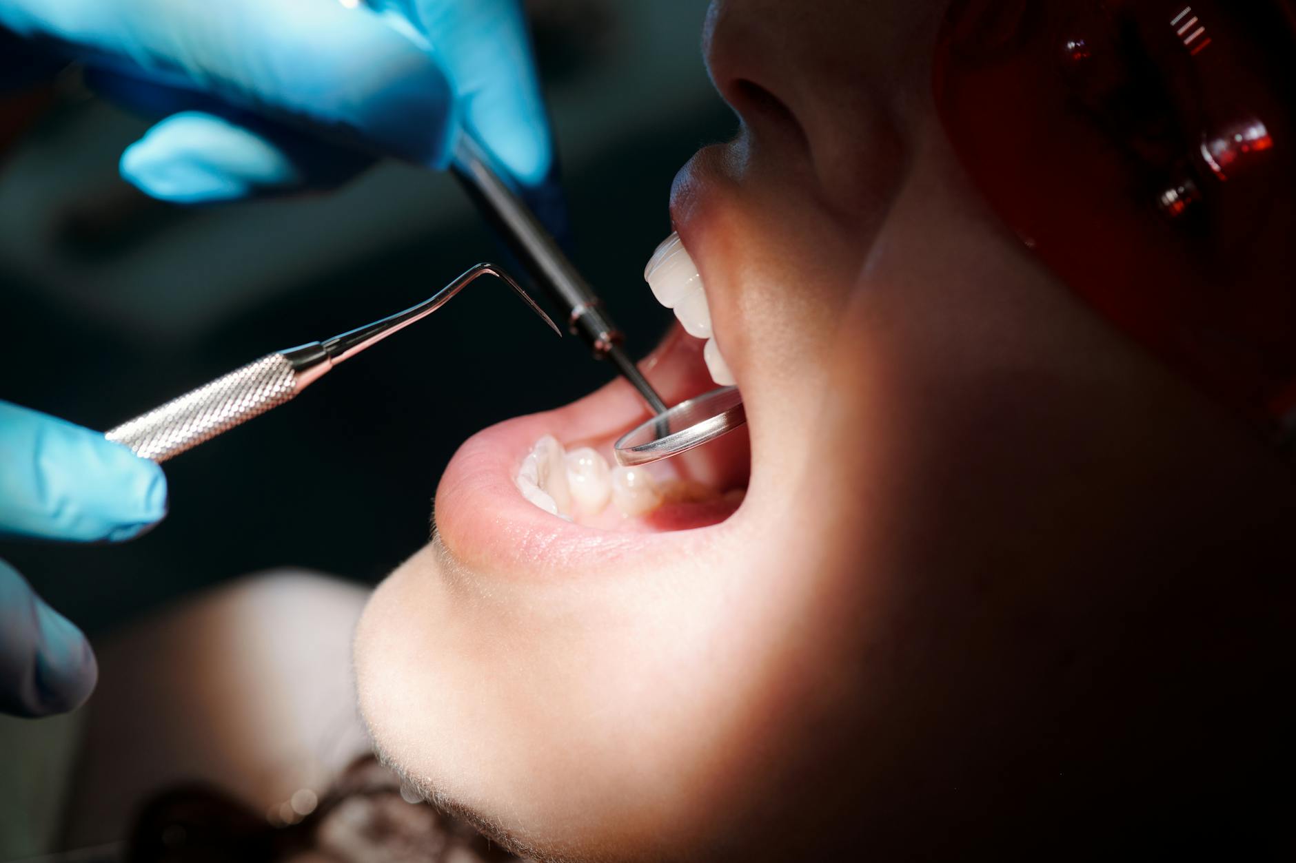 Detailed close-up of a dental check-up with tools and patient under bright light.