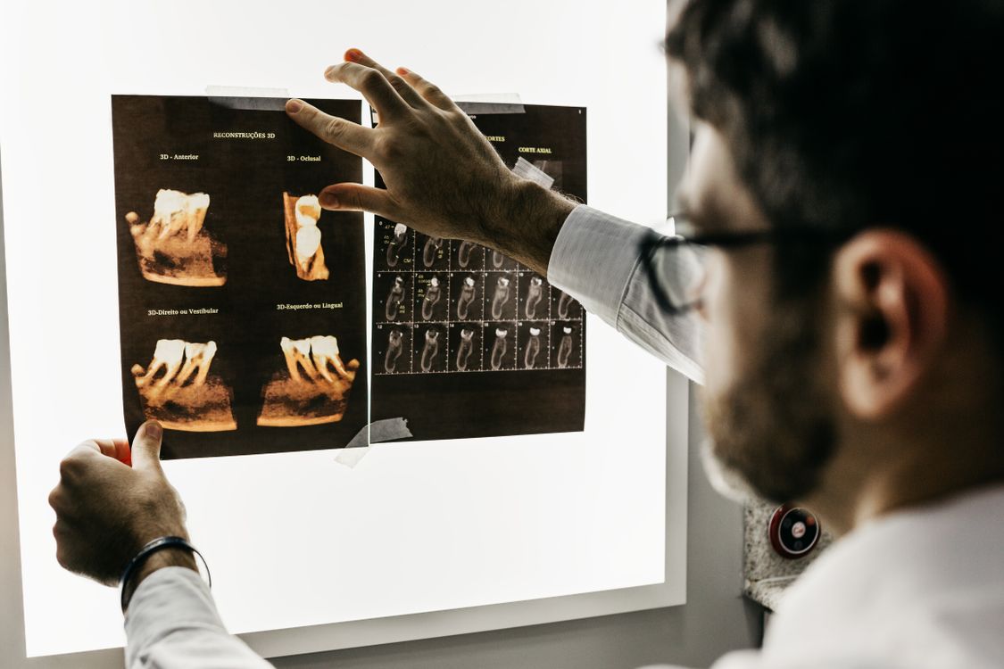 Dentist reviewing dental x-rays to plan crown treatment and discuss outcome with patient