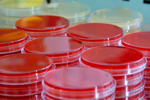 Transparent containers with blood samples in lab