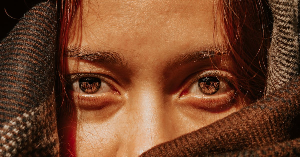 Does Cagney insurance cover last eye surgery