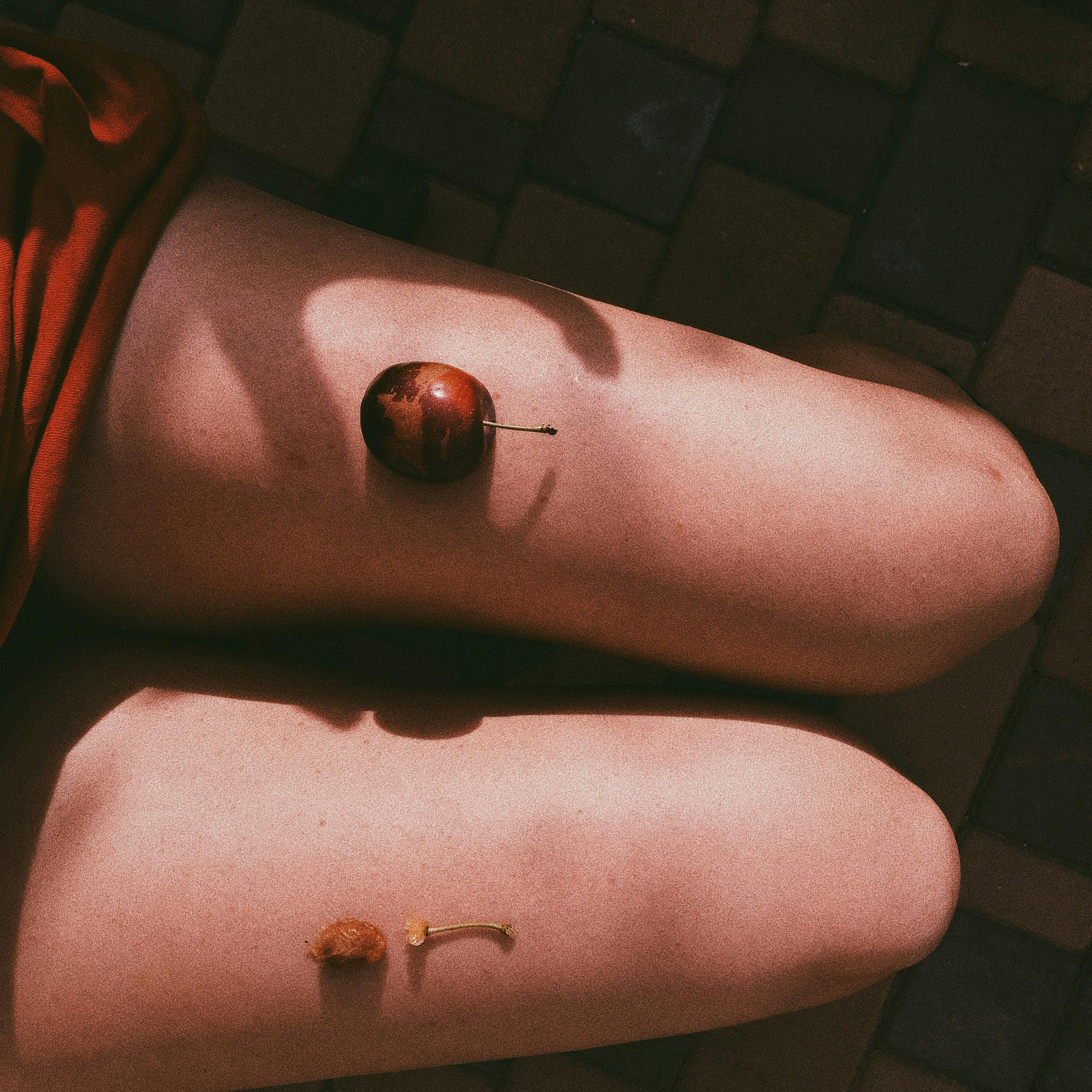 Does vitamin C cause kidney stones?