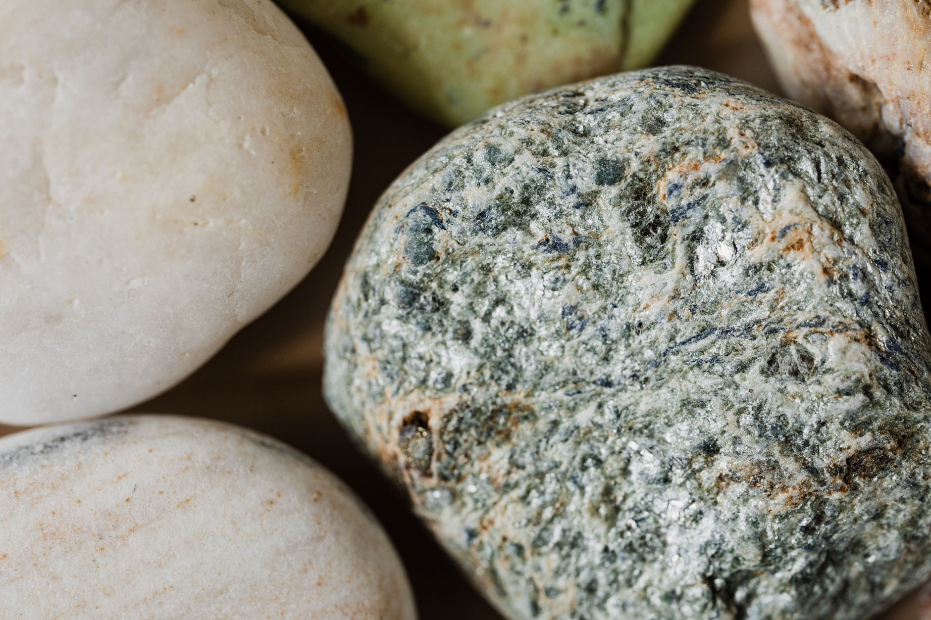Bladder Stones vs. Kidney Stones: Understanding the Differences