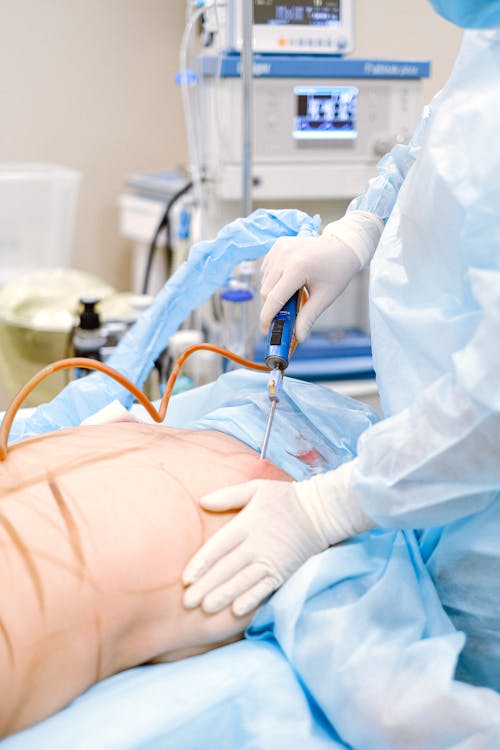 Free Photo of Medical Professional Doing a Liposuction on a Patient Stock Photo