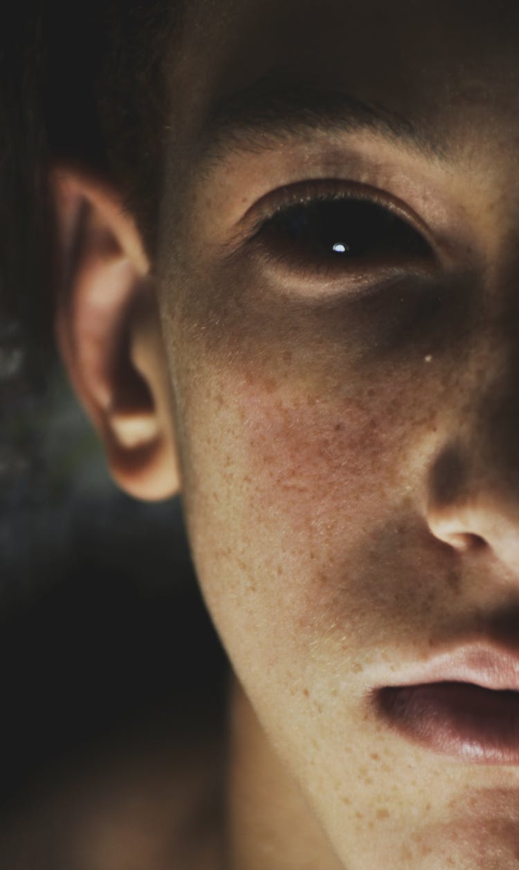 Teen Boy With Freckled Face