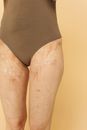 Person in Black Underwear Standing