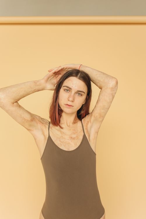 Free Confident woman in a brown swimsuit embracing her scars against a beige background. Stock Photo