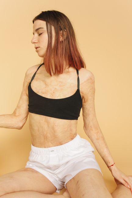 Caucasian woman with brown hair posing in black bra and white shorts against a yellow background.