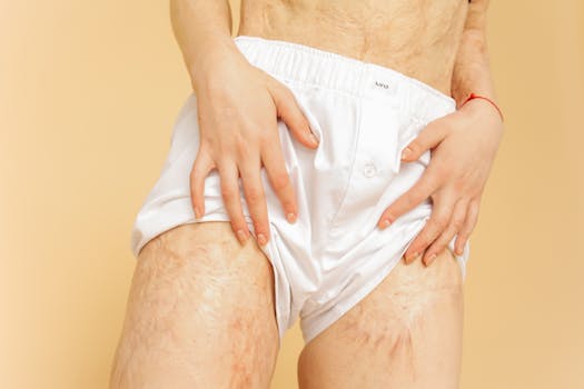 A close-up image showing hands resting on scarred skin, wearing white boxers.