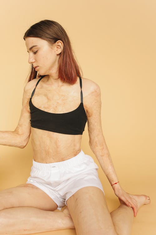 Young Woman in Black Bra and White Shorts