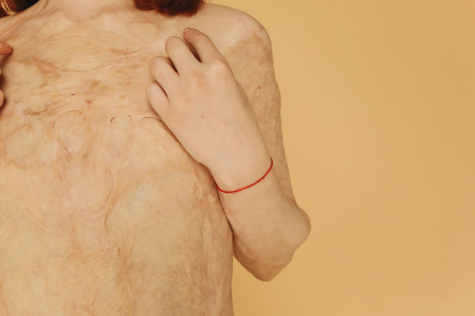 Skin Transformation: Real Results from Regular Use