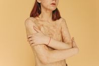 一位拥抱伤疤的女人肖像在黄色背景上