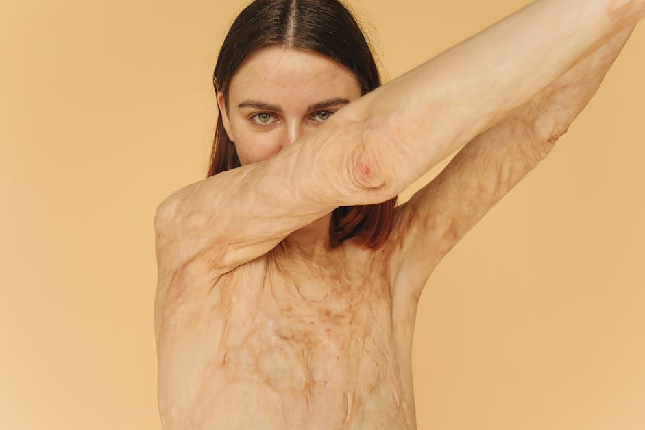 Woman Shows Burn On Her Chest Stock Photo 2321983571