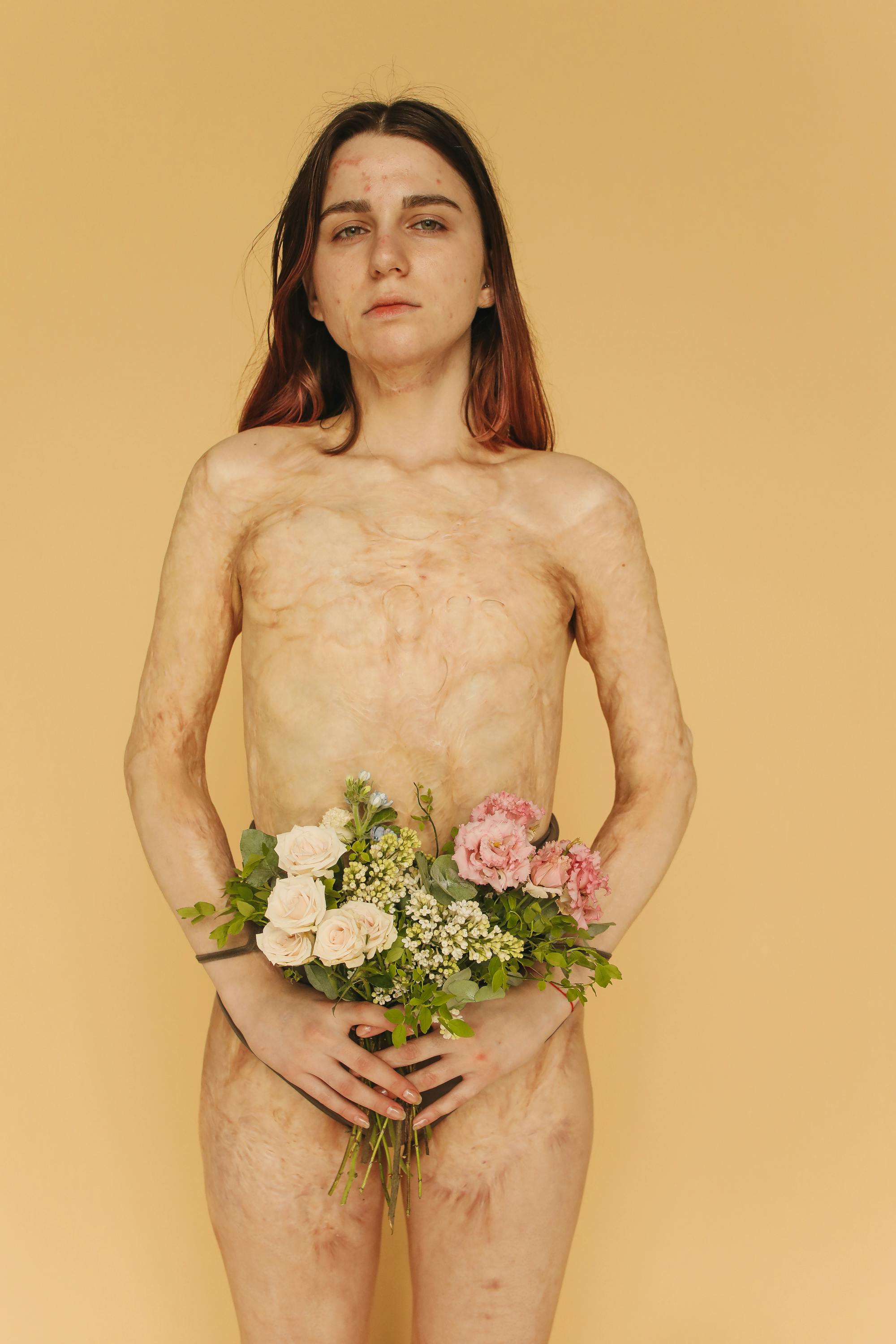 portrait of a woman with burn scars