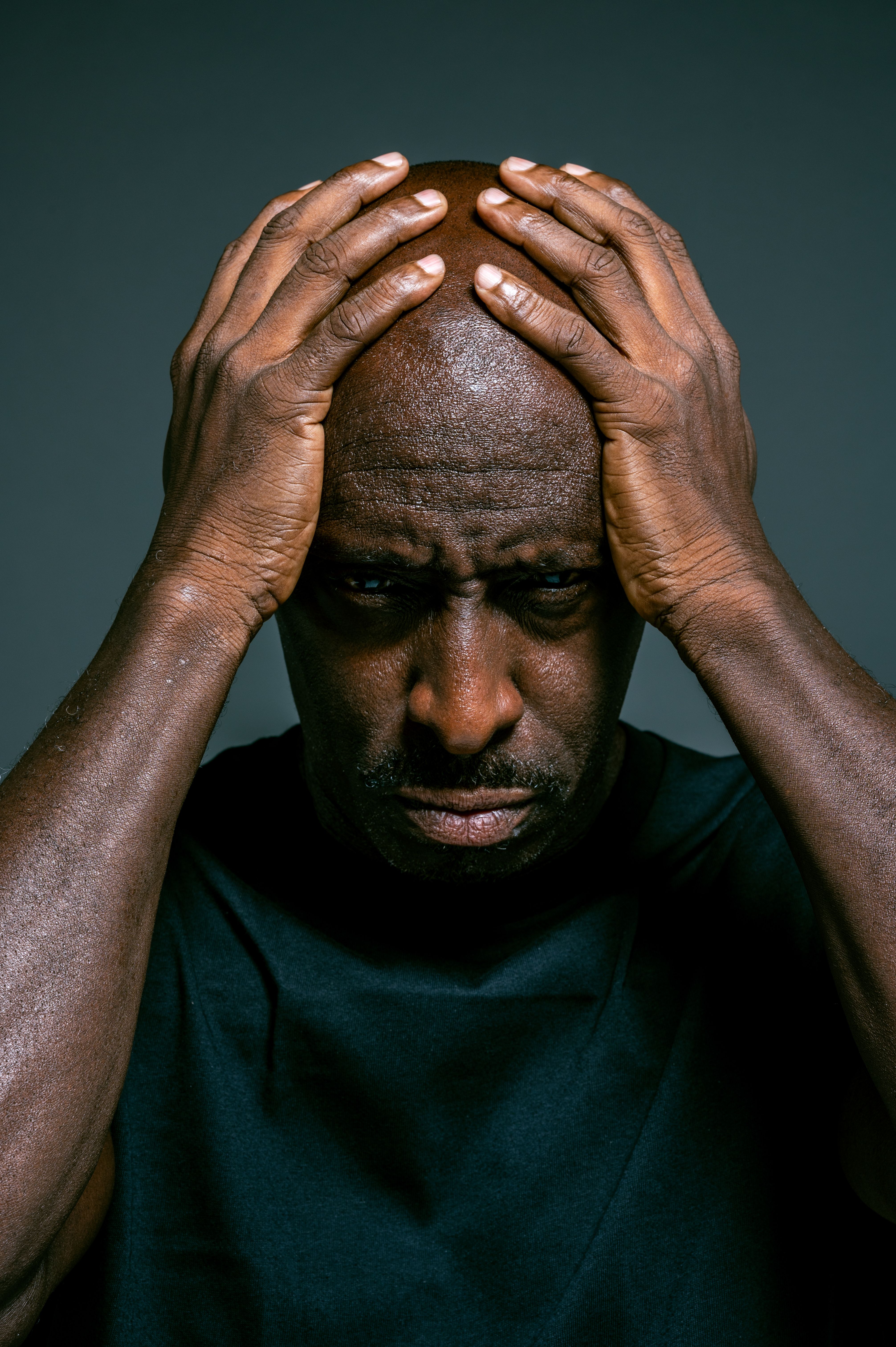 A close-up portrait of a bald man with a serious expression and hand on head.