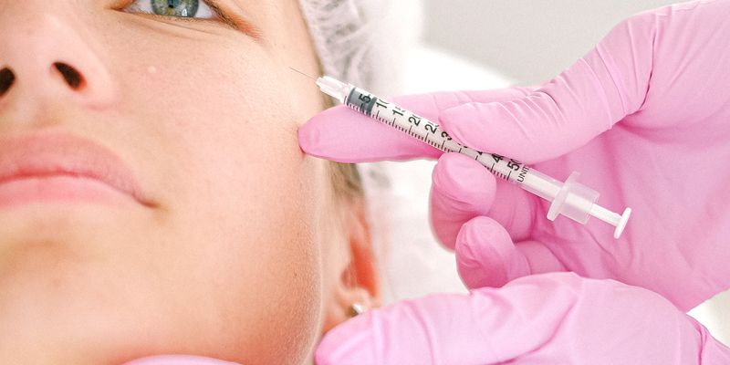 Inserção de fio de sustentação com cânula facial