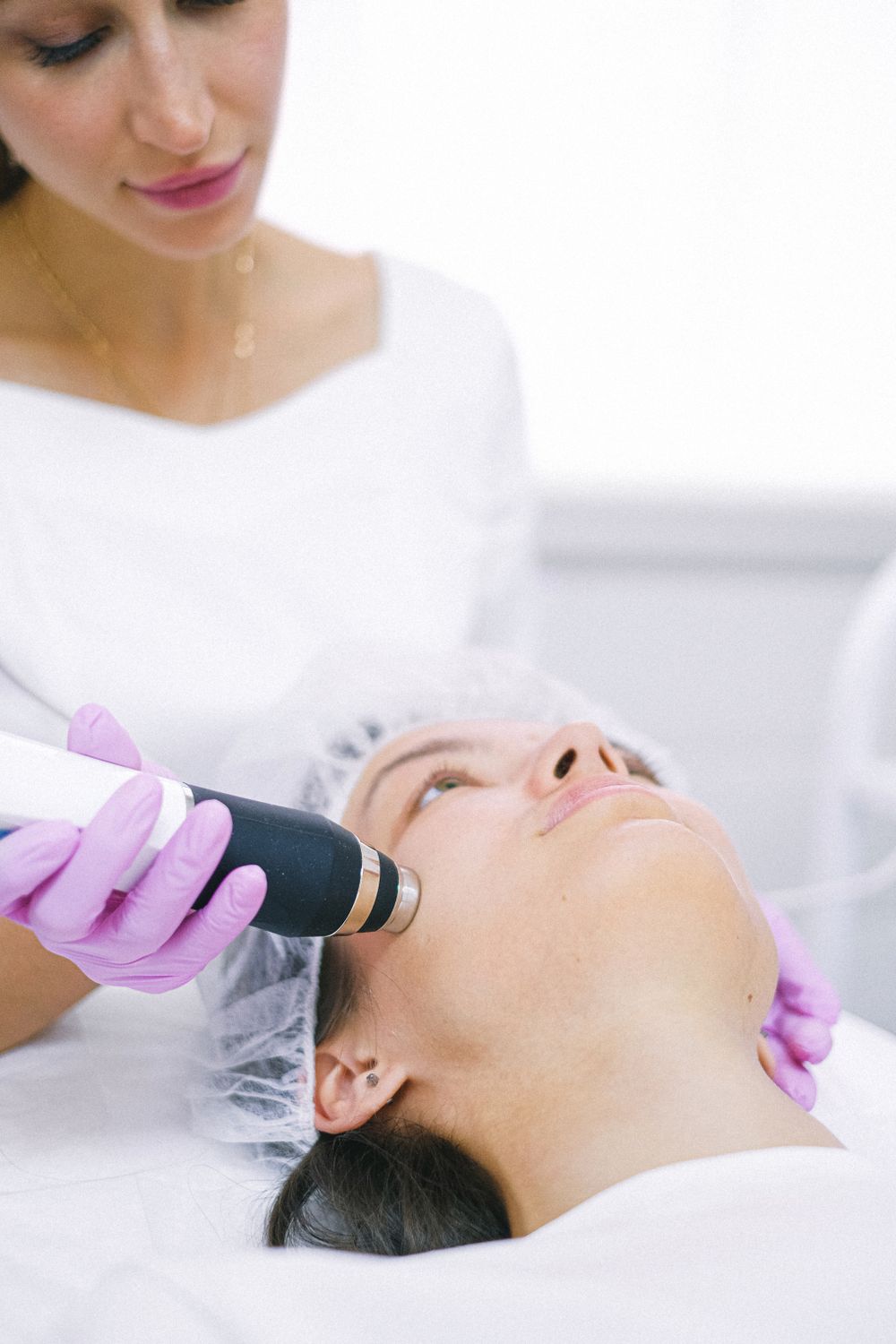 Targeted facial pigmentation treatment
