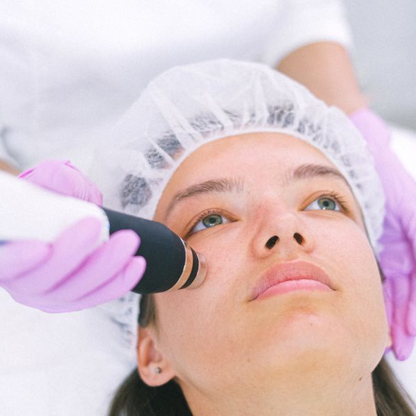 Laser facial treatment