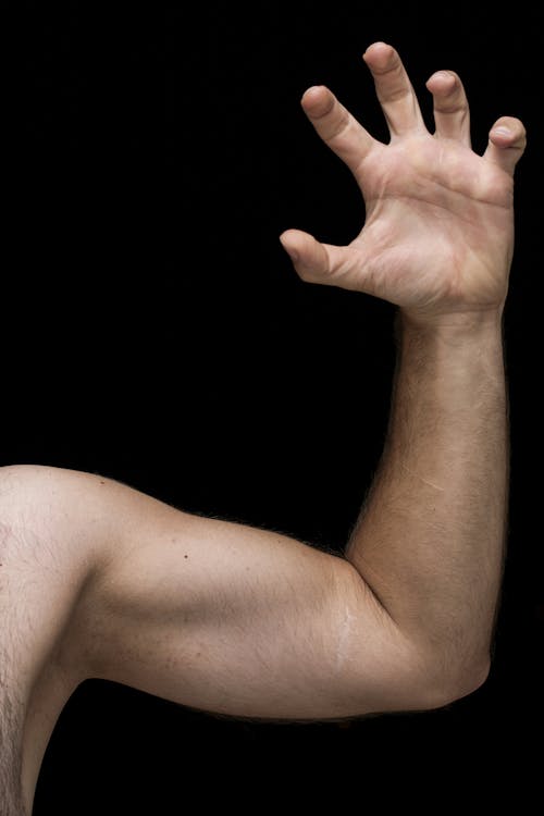 Person's Left Arm