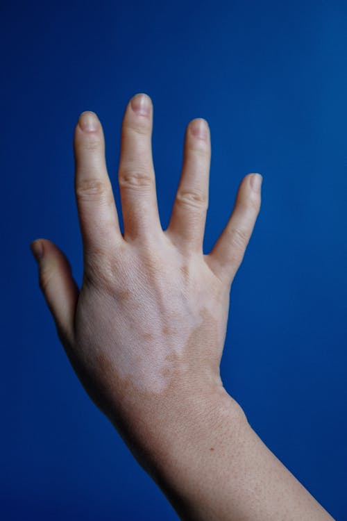 Photo Of Person's Hand