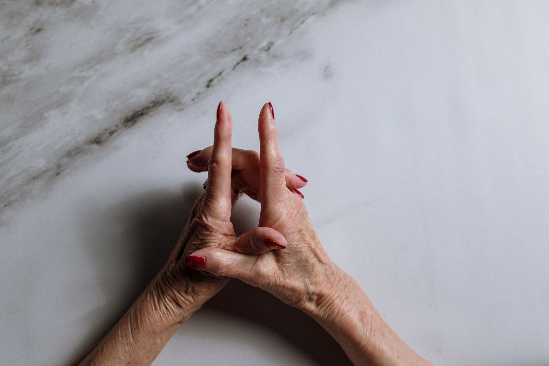 Finger Joint Replacement Surgery: A Comprehensive Guide for Indian Patients